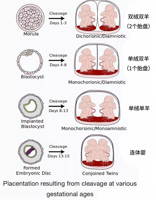 做试管婴儿，移植两个胚胎就一定能怀上双胞胎吗？
