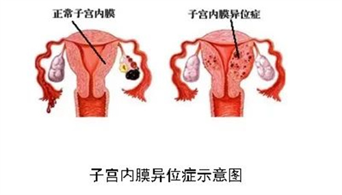 “结婚两年没怀上，去检查医生说激素偏低，我还能怀上宝宝吗？”