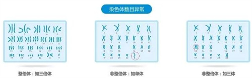 孕早期HCG翻倍不佳，这4个原因不可忽视！