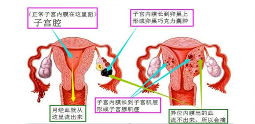 50%的难孕人群，都是因为这个因素在作怪！
