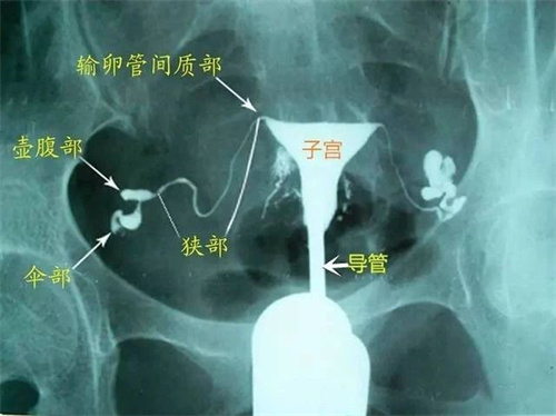 明明都成功受精了，为什么还是怀不上？