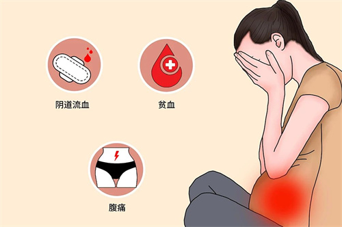 高泌乳素血症，也是会影响怀孕的！