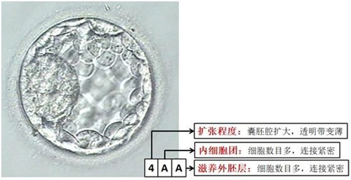 做试管婴儿低质量的囊胚，还有移植的必要吗？