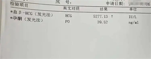 胚胎移植成功后必查的HCG，你究竟了解多少？