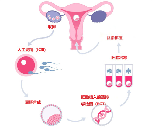 乳糜泻引发的不孕可以做试管婴儿解决吗？