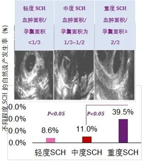 绒毛膜下出血是怎么回事？对怀孕有影响吗