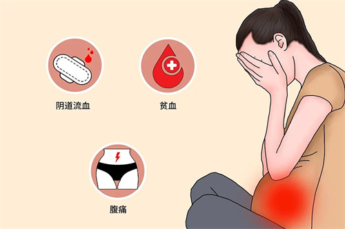做试管婴儿为什么还会复发性流产？别忘了查封闭抗体！