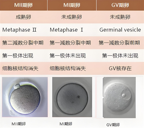 试管婴儿科普：取卵报告中的MII、MI、GV分别是什么意思？