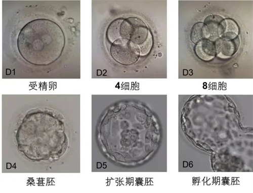取卵后“第3天”胚胎的去向选择！