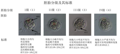 胚胎质量不好怎么办？做好这2点很关键！橄榄树生命将为您揭秘“逆袭法则”