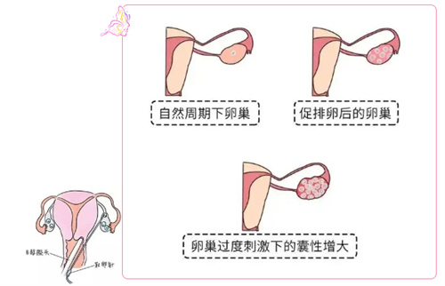 妇女节特辑 | 献礼三月，“好孕”正当时！