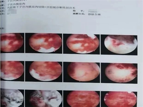 影响胚胎着床的“元凶”，你排查了么？