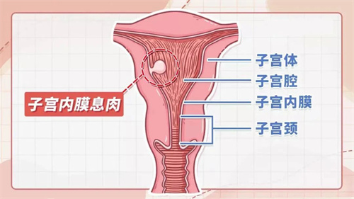 影响胚胎着床的“元凶”，你排查了么？