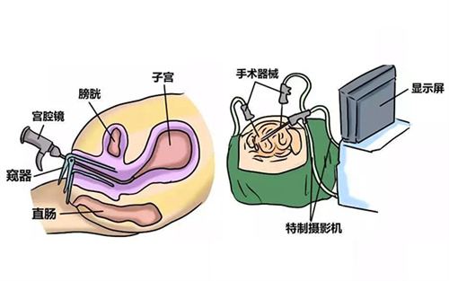 影响胚胎着床的“元凶”，你排查了么？