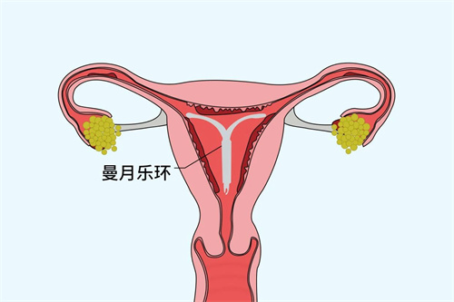影响胚胎着床的“元凶”，你排查了么？