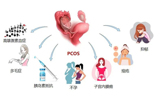 国家喊你减肥啦！多囊姐妹快来看这4条干货