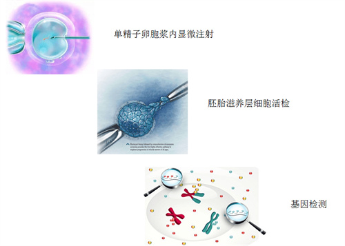 世界唐氏综合征日| 第三代试管婴儿技术，为新生命护航！