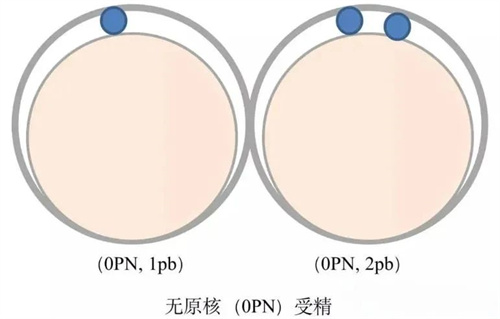 异常受精形成的胚胎，是不是移植无望？