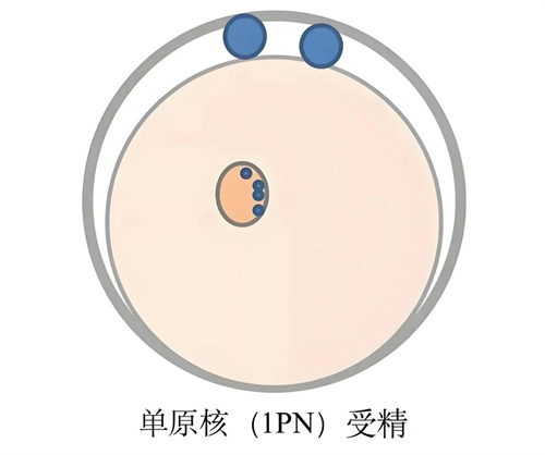 异常受精形成的胚胎，是不是移植无望？