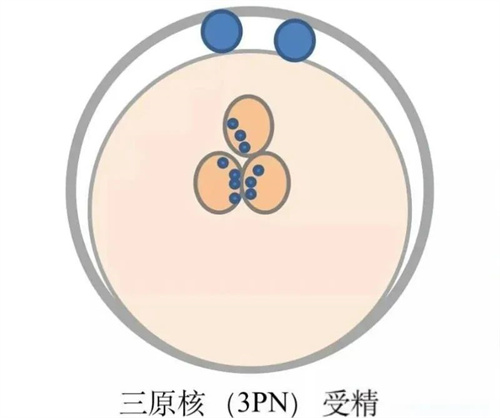 异常受精形成的胚胎，是不是移植无望？