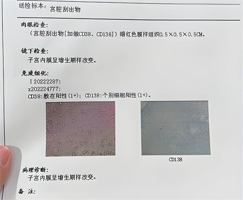 做试管婴儿反复移植失败，通常是忽略了这个重要原因！