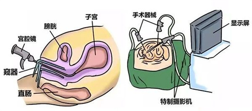 做试管婴儿反复移植失败，通常是忽略了这个重要原因！