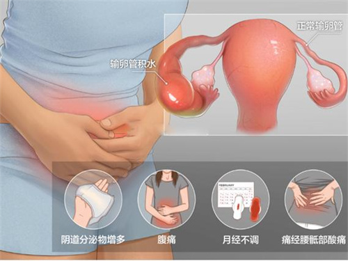 试管婴儿科普：造成不明原因的不孕因素，您知道几个？
