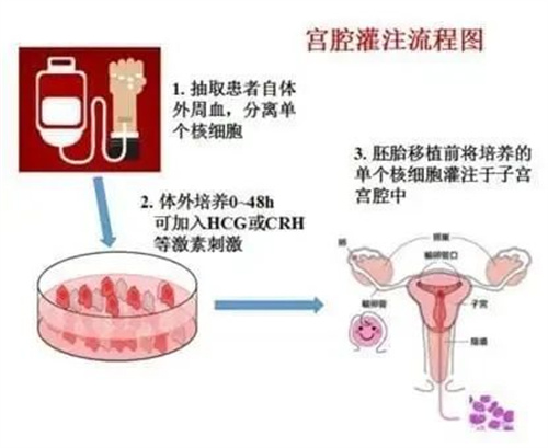 内膜薄的实用治疗方法，总有一种适合你！