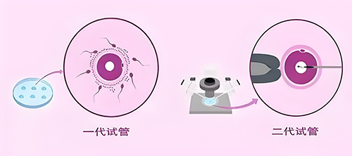 7年！16次！3200针！白冰冰自曝试管求子血泪史