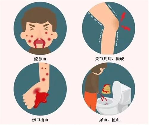 世界血友病日| 用三代试管婴儿技术破解“血之诅咒”！