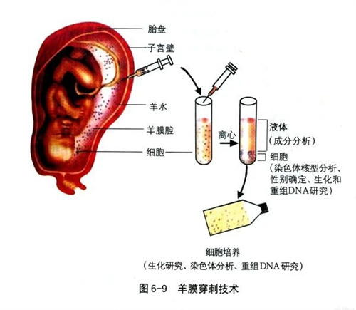 世界血友病日| 用三代试管婴儿技术破解“血之诅咒”！