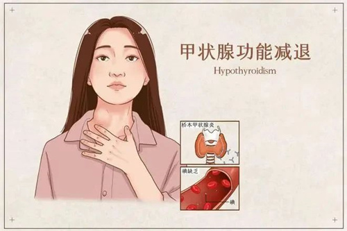 反复流产，久备不孕？病因竟在脖子上！