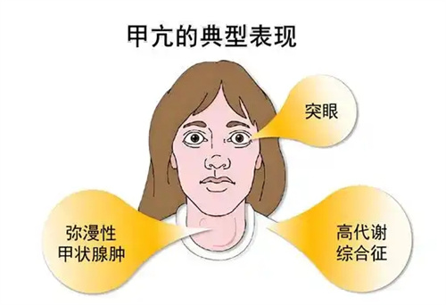 反复流产，久备不孕？病因竟在脖子上！