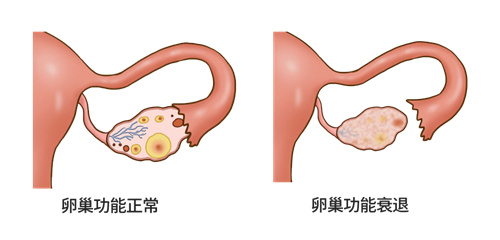 月经总是提前，是你的卵巢在求救…