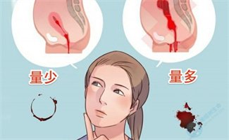 注意！这5种出血≠月经紊乱！或可致不孕，现在重视还不晚！