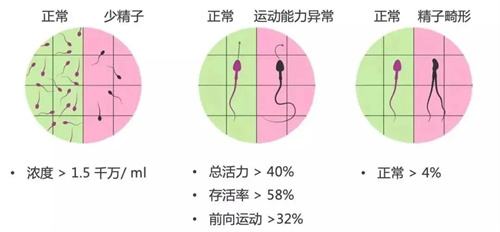 做试管婴儿，关于男性精子问题，看这篇就够了！