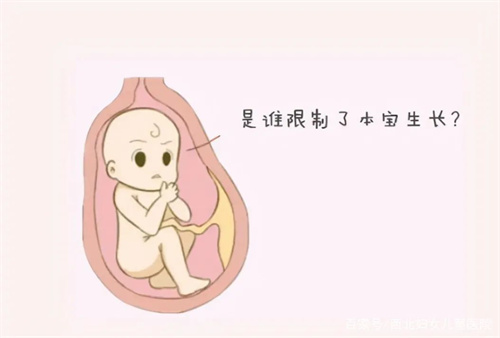 别太羡慕怀双胎，这些风险你知道吗？