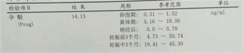 孕早期胎停并非毫无征兆，这个“隐藏杀手”要知道！