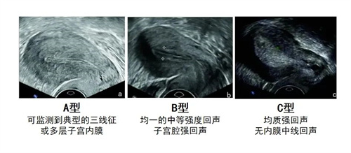 内膜要养到多厚，才能让胚胎成功着床？