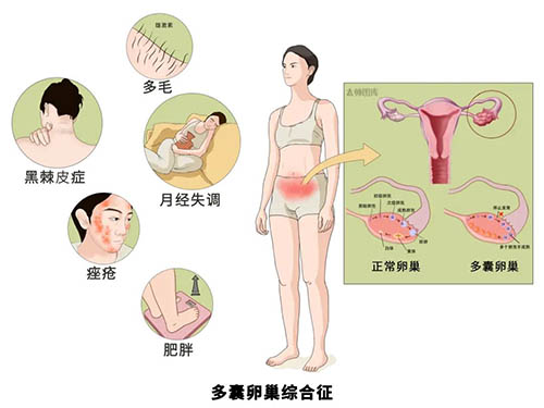端午安康 | "粽"有妙方，好孕相伴！