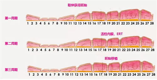 多次移植不着床？胚胎移植“黄金窗口”了解一下！