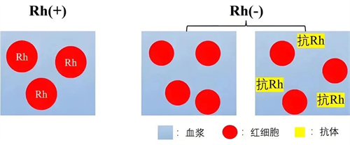 血型不合的隐形危机：新生儿溶血的科学预防指南