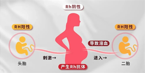 血型不合的隐形危机：新生儿溶血的科学预防指南