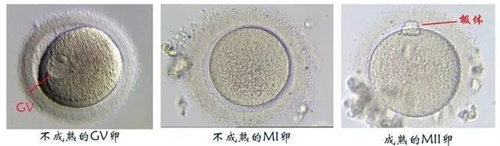 卵子成熟障碍，还有机会怀孕吗？
