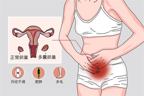 卵子成熟障碍，还有机会怀孕吗？