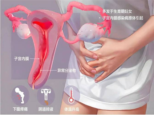 备孕总失败？权威报告揭秘：1/3难孕体质竟藏着未察觉的隐秘绊脚石