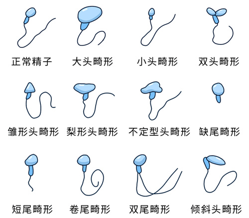 怀孕路上的“拦路虎”，你听过几个？