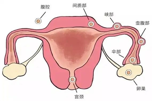 试管婴儿100问合集（一）