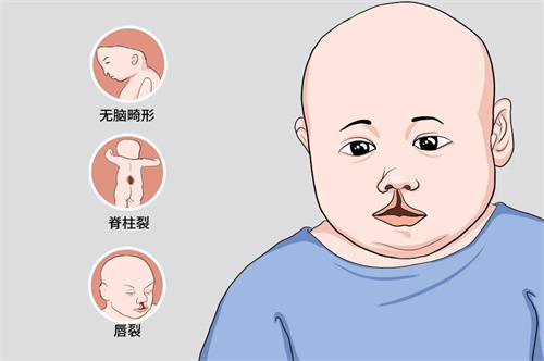 不搞清这些问题，劝你别随便补充叶酸！