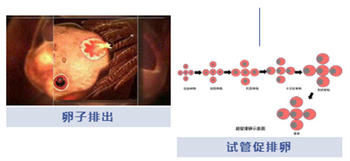 试管婴儿100问合集（四）